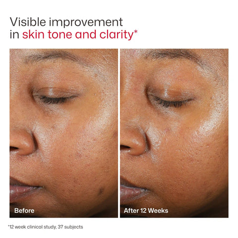 UV Clear Broad Spectrum SPF 46