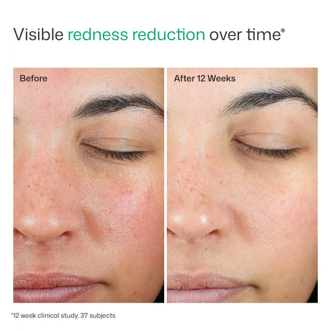 UV Skin Recovery Red Color Correcting Green Tint Broad Spectrum SPF 50